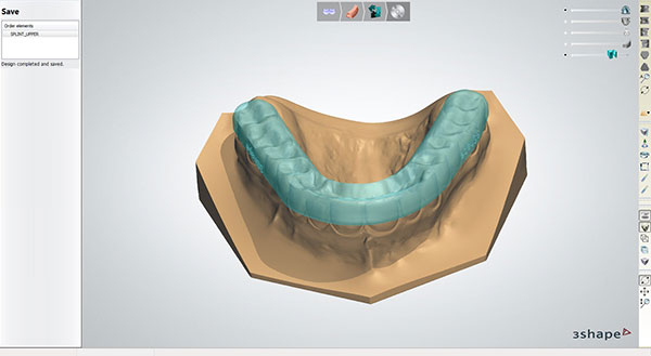 3Shape Splint Designer software