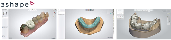 next generation Dental System 2014
