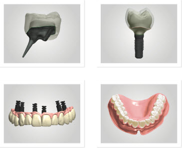 3Shape Dental System 2013