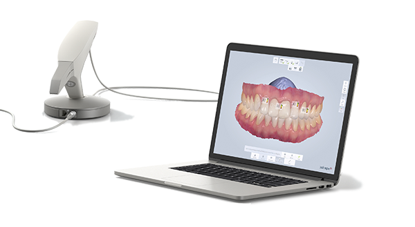 3Shape TRIOS and the software